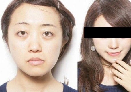 【画像】海外サイトで紹介されていた ”アジア人の女の子が目を大きくする方法” ・・・