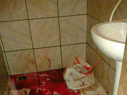 【閲覧注意】トイレの便器が割れて、女性の背中も割れた