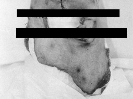 【閲覧注意】恐ろしい画像。父親を殺し、顔の皮を剥いでかぶった息子