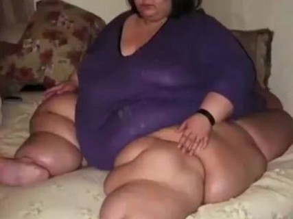 【画像】450kgの女性、痩せる