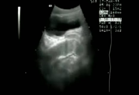 男性器を女性器に入れているMRIの ”アップ” 映像凄いなこれ