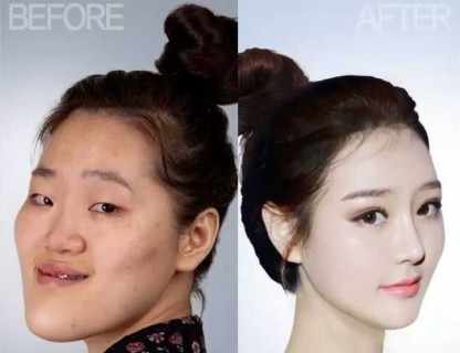 【画像】韓国の超美女たちの ”整形前の顔” 、もはや誰だか分からないレベル・・・
