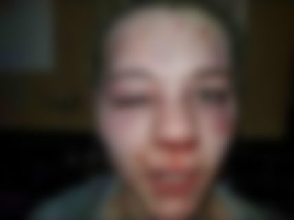【悲報】モテモテの10代ギャル、2分間顔をボコボコにされ精神が崩壊する（動画あり）