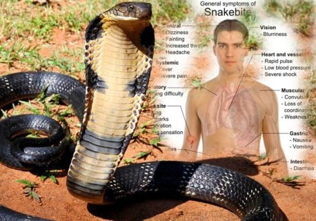 【恐怖】インドで毒蛇に咬まれて死亡した高校生の映像来てたけど怖すぎる…