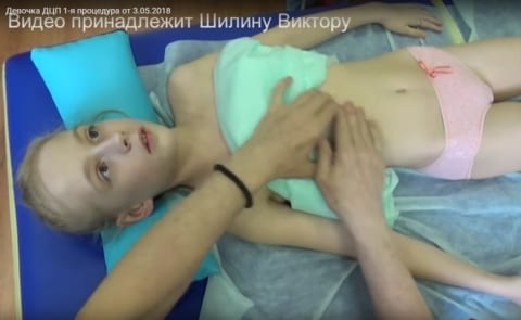 【動画】ロシアの美少女（パンツ1枚）の脳性麻痺治療動画。ロリコンたちが歓喜してる様子…
