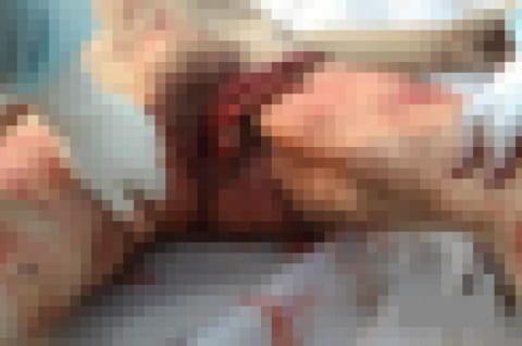 【超！閲覧注意】マ●コから腸を出され、その腸で絞め殺された女性が発見される（画像）