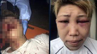 【悲報】北九州のヤンキー2人組(24)、広島の番長(19)に二人まとめて半殺しにされてしまう