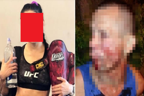 【衝撃画像】女性格闘家「私を襲ってきた男をこんな姿にしてやりましたｗｗｗ」