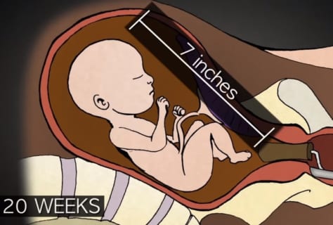 【閲覧注意】妊娠4カ月を超えてからの中絶、あまりにも非人道的すぎる（動画あり）