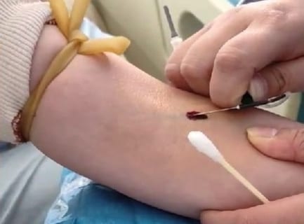 【閲覧注意】看護師が採血の注射をミスった6秒動画が「鳥肌立つ」と話題に