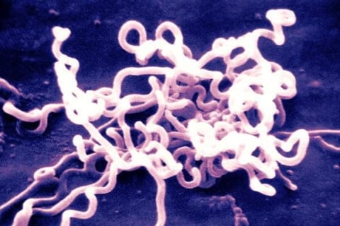 【閲覧注意】日本で７０００人が感染している細菌、ガチでとんでもない・・・（画像あり）