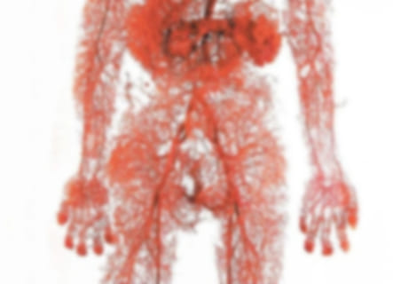 【閲覧注意】人間から ”血管だけ” を抜き出したらこうなる（画像）