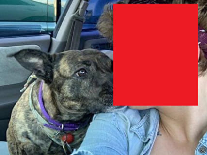 【閲覧注意】飼い犬に顔面を破壊された女。その後彼女は犬をこうした…（画像）