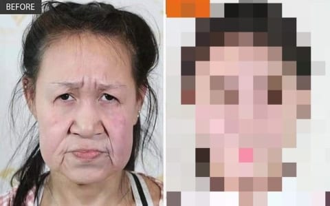 【超衝撃】おばあちゃんにしか見えない15歳の中国人少女、整形した結果・・・（画像）