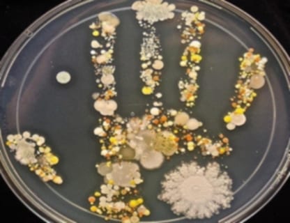 【閲覧注意】人の手を培養皿につけ、2日間保温したら恐ろしいほどの菌が沸いた