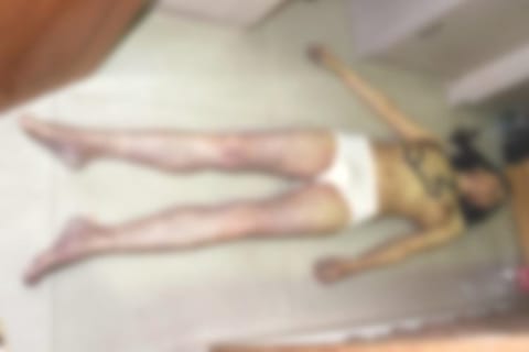 【閲覧注意】美少女が首吊り自殺 ⇒ 全裸にされ晒される（画像あり）