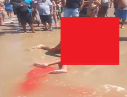【閲覧注意】海水浴場にまたサメが出現！！襲われた男性の姿がヤバイ…（画像あり）