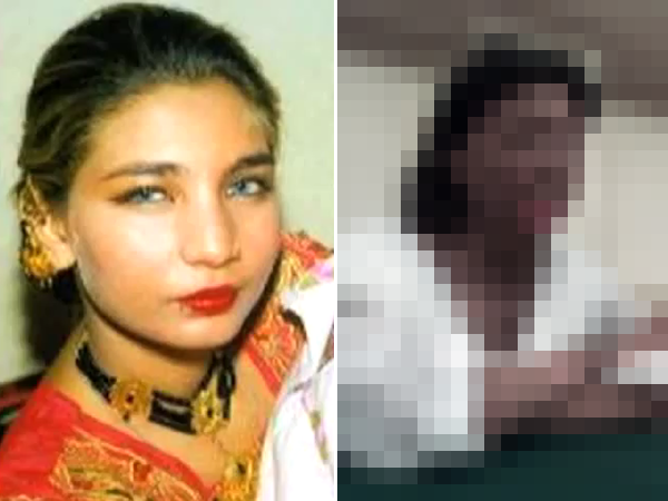 【閲覧注意】顔面に酸をかけられた美女、39回にも及ぶ手術のうえ自殺
