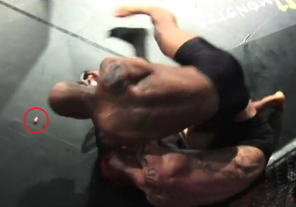 【閲覧注意】MMAの試合中エルボーを食らった選手の耳が吹き飛ぶ。（動画）