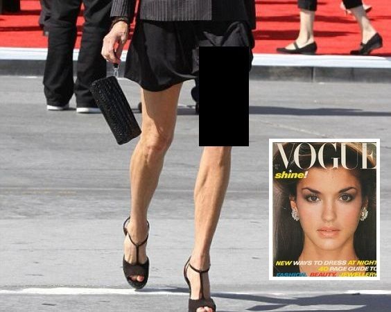 何これ？57歳になった元スーパーモデルの足がやばい事に