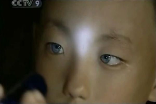 ［中国］暗闇でも見える…「猫の眼」を持つ少年が話題に