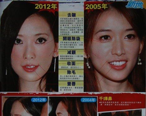 台湾の美人女優「リン・チーリン」、顔面整形 比較画像