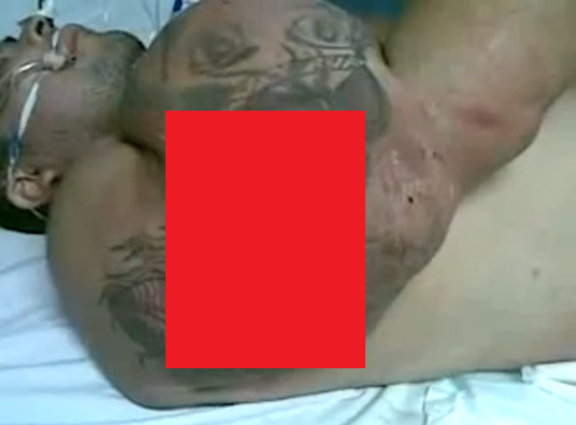 【閲覧注意】筋肉を求めすぎたボディビルダーの、腕が爆発