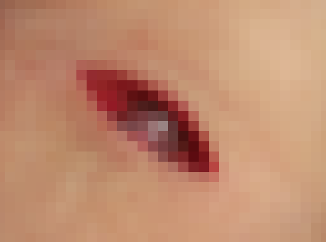 【閲覧注意】ヤバい写真。自分の腕を切ってたら「動脈」が見えた…