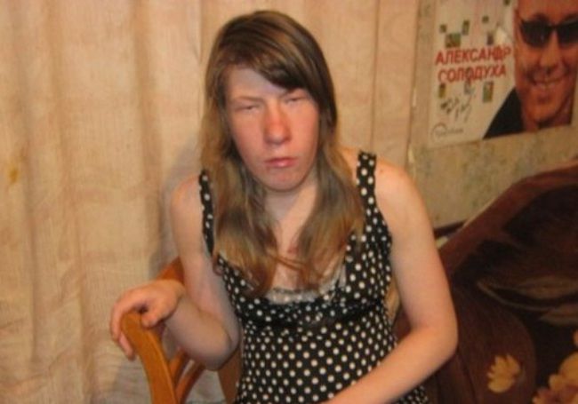 「なんだこいつの顔は！？」とんでもなくブサイクな女の子がロシアで話題に