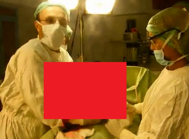 【閲覧注意】26歳の女性のお腹の中から出てきたものが凄い