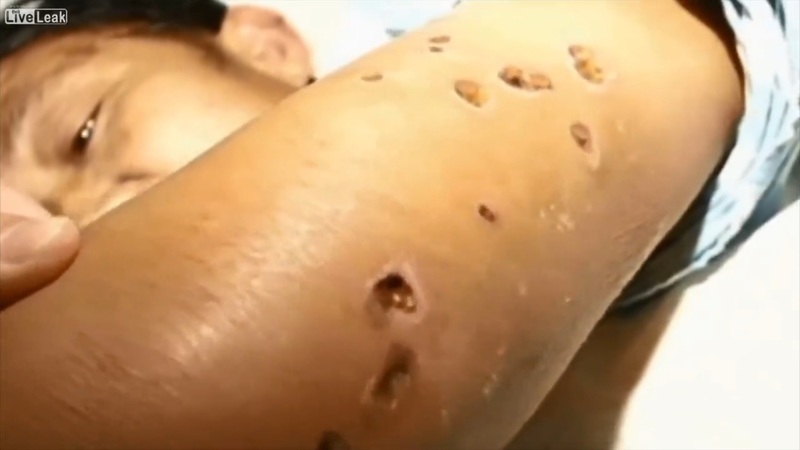 s9Zepkt3xuIMf4y1381307677