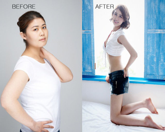 before_and_after_photos_of_korean_plastic_surgery_part_2_640_59