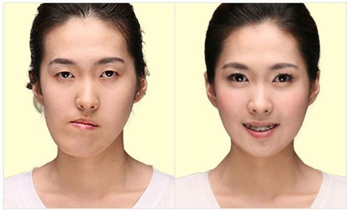 south_korea_surgery_09