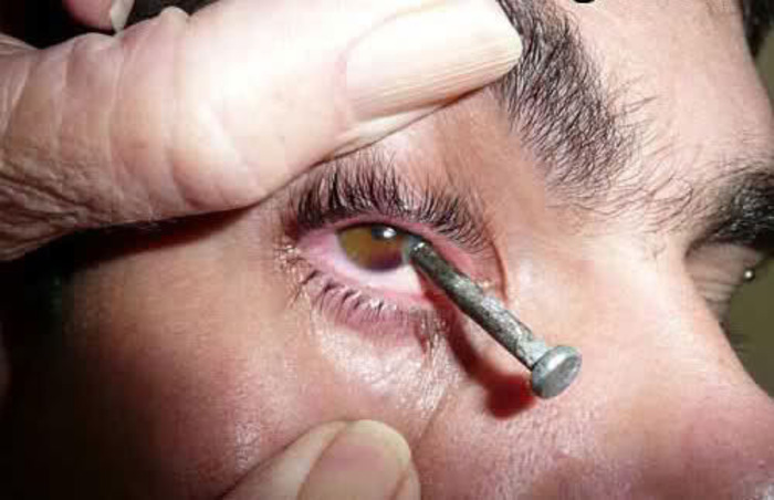 PVzAD4CYk8dJiJO1387346427_1387346435