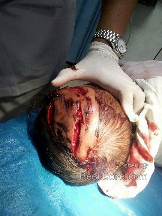 3-months-old-baby-mauled-horrific-dog-attack-thailand-01