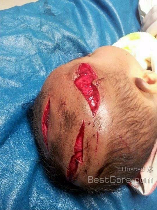 3-months-old-baby-mauled-horrific-dog-attack-thailand-02