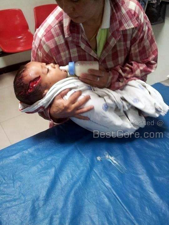 3-months-old-baby-mauled-horrific-dog-attack-thailand-03
