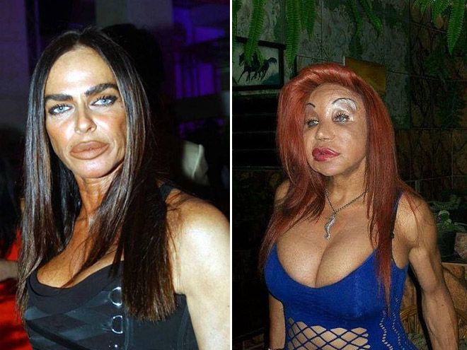 plastic_surgery_06