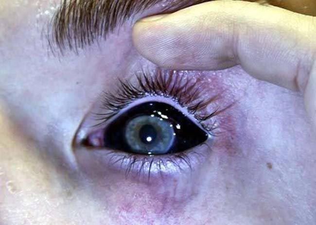 tattooed_eyeballs_03