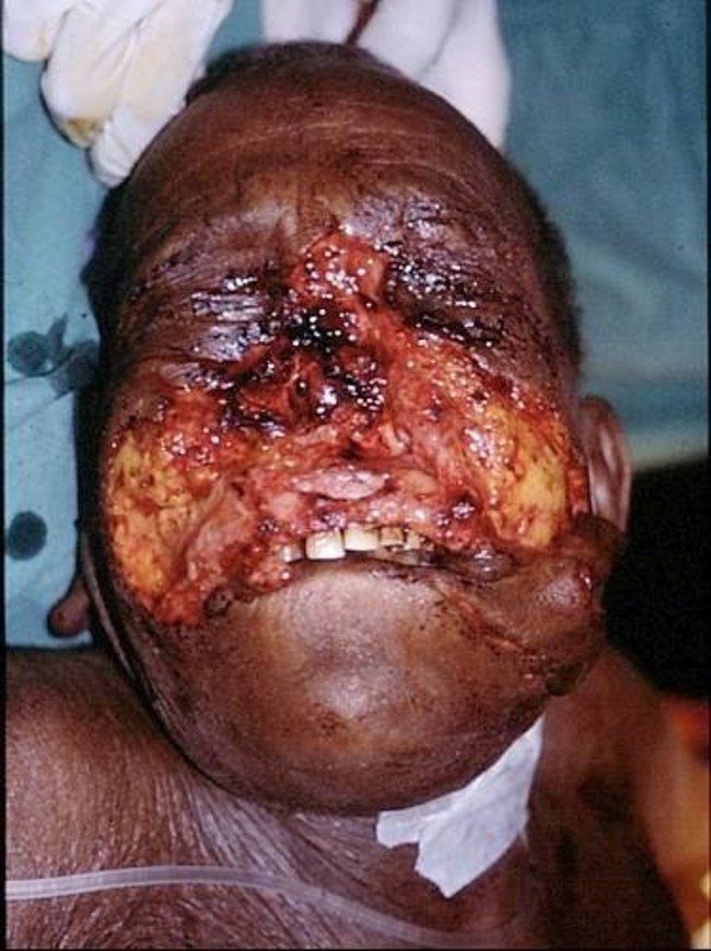 FkLmRy9aQcHpzwn1423977453_1423977458