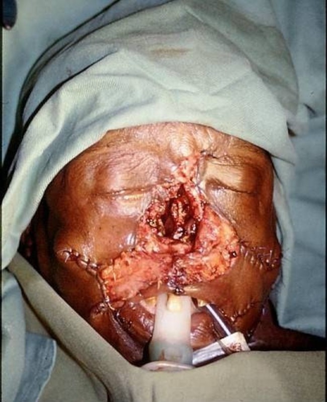 FkLmRy9aQcHpzwn1423977453_1423977462