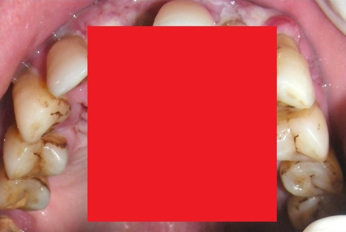 Z03XimVtl0ln67P1423904487