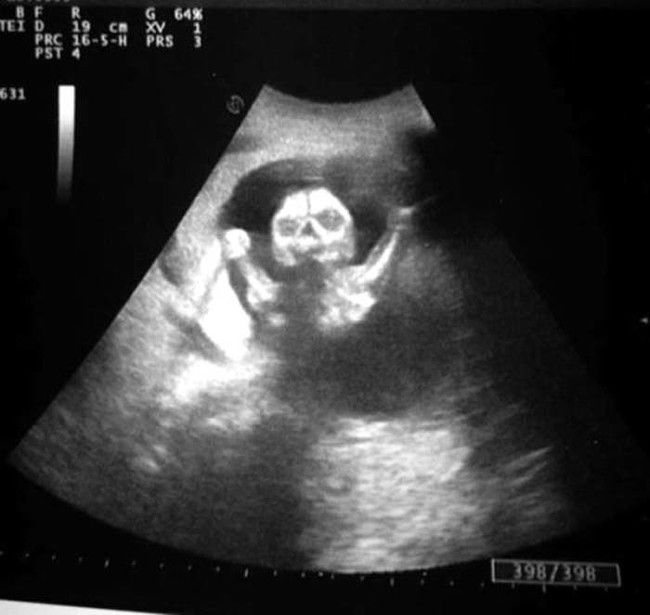 ultrasound_scare_03