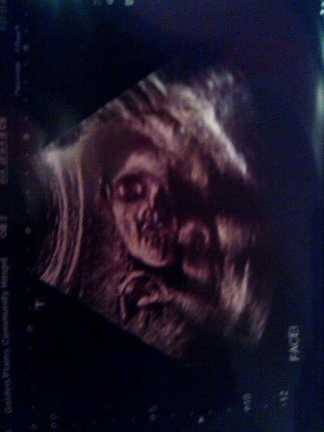 ultrasound_scare_07