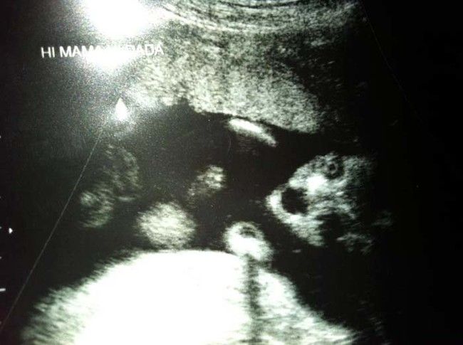 ultrasound_scare_13