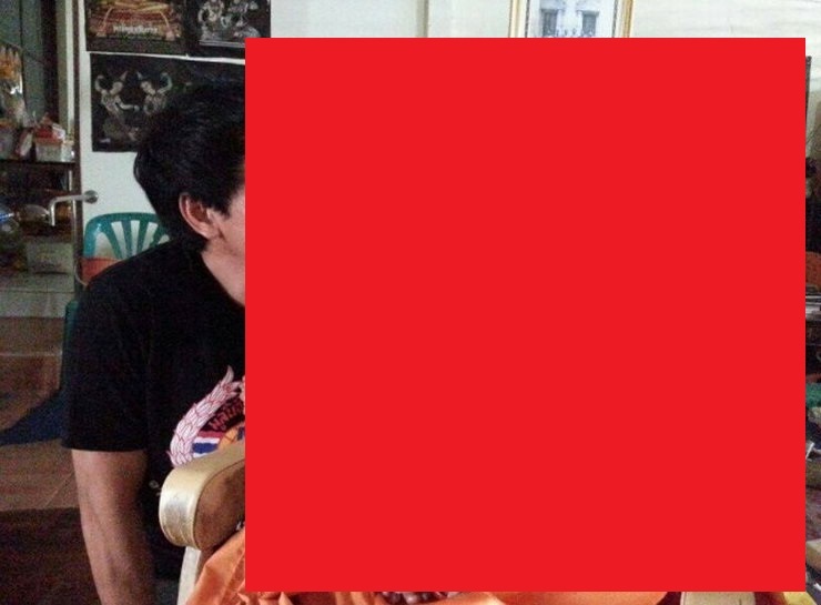 【超！閲覧注意】彼に何が起こった？ マジでヤバい画像