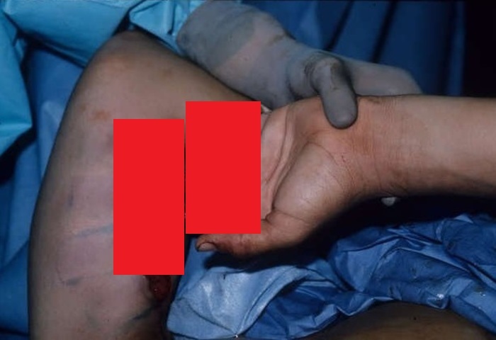 DKhL4_fw3S1VUDZ1428041033