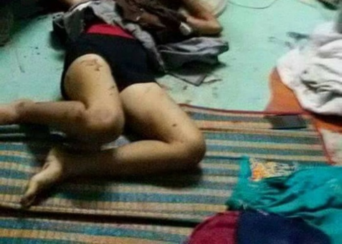 【閲覧注意】あそこにあれがまだ突き刺さったまま発見された女性
