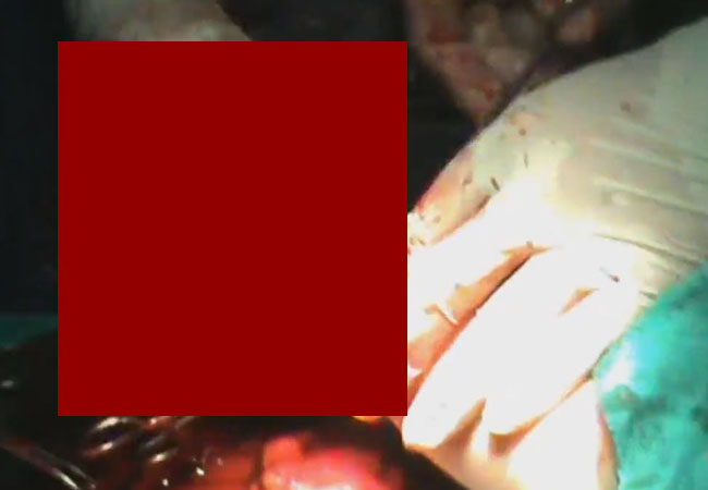 【閲覧注意】女の子の足を切り落としていくよー（動画）