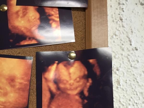 SNJi7MBqVPibn6F1439889285